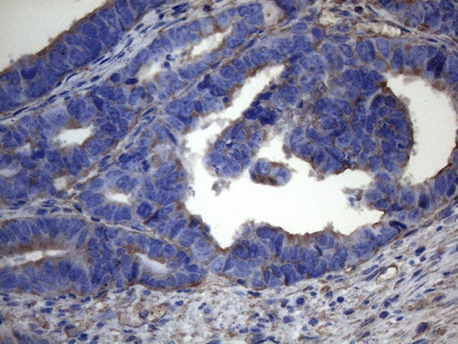 IRF3 Antibody in Immunohistochemistry (Paraffin) (IHC (P))