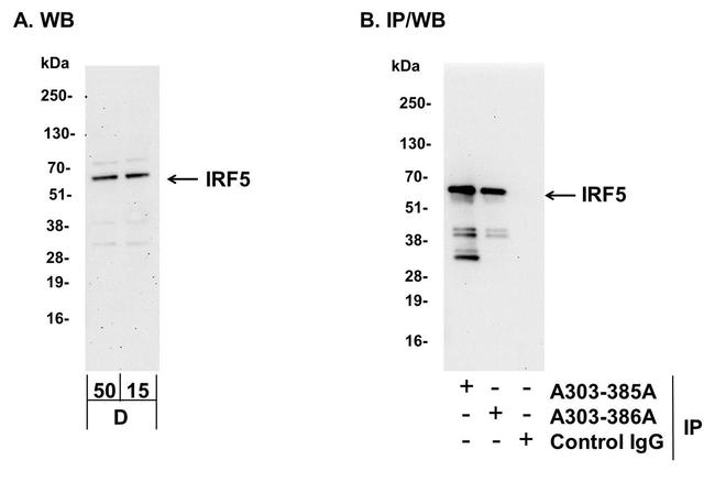 IRF5 Antibody in Western Blot (WB)