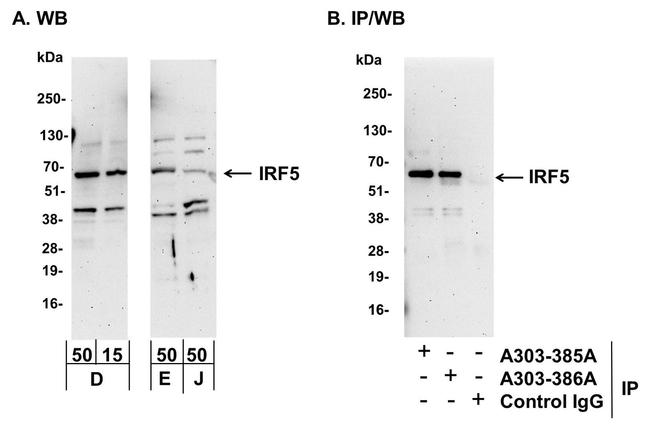 IRF5 Antibody in Western Blot (WB)