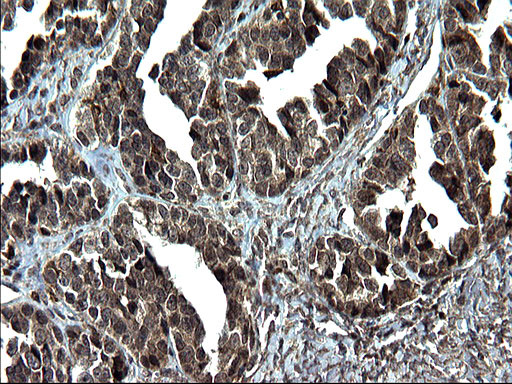 IRF5 Antibody in Immunohistochemistry (Paraffin) (IHC (P))