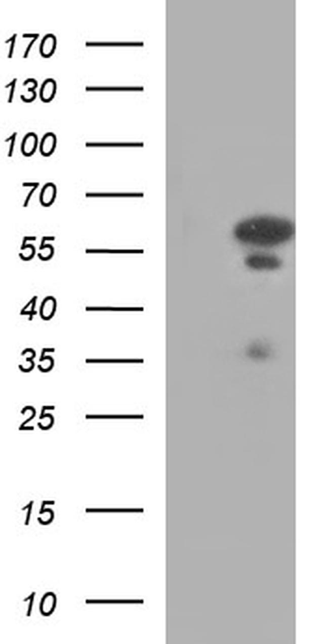 IRF5 Antibody in Western Blot (WB)