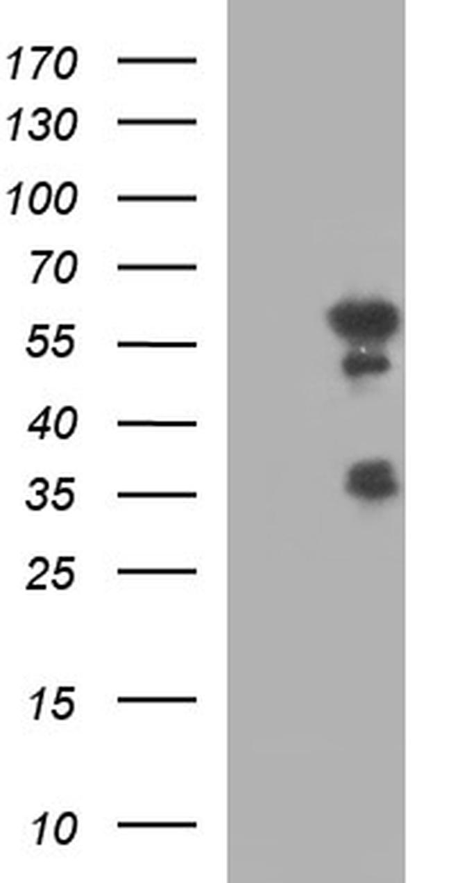 IRF5 Antibody in Western Blot (WB)