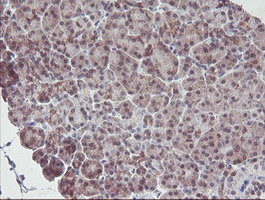 IRF6 Antibody in Immunohistochemistry (Paraffin) (IHC (P))