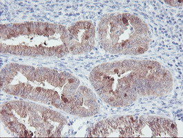 IRF6 Antibody in Immunohistochemistry (Paraffin) (IHC (P))