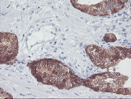 IRF6 Antibody in Immunohistochemistry (Paraffin) (IHC (P))