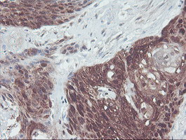 IRF6 Antibody in Immunohistochemistry (Paraffin) (IHC (P))