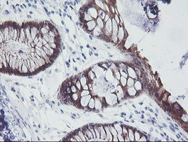 IRF6 Antibody in Immunohistochemistry (Paraffin) (IHC (P))