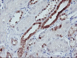 IRF6 Antibody in Immunohistochemistry (Paraffin) (IHC (P))