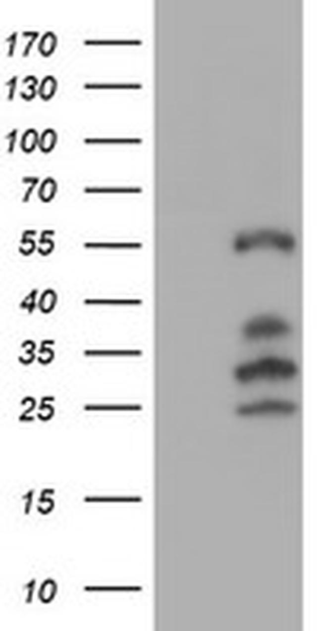 IRF6 Antibody in Western Blot (WB)