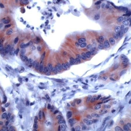 IRS1 Antibody in Immunohistochemistry (IHC)