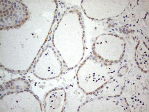 IRS1 Antibody in Immunohistochemistry (Paraffin) (IHC (P))