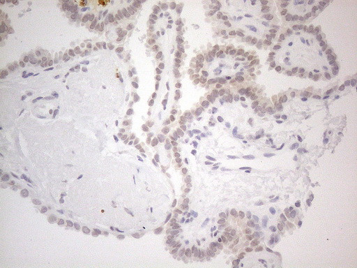 IRS1 Antibody in Immunohistochemistry (Paraffin) (IHC (P))