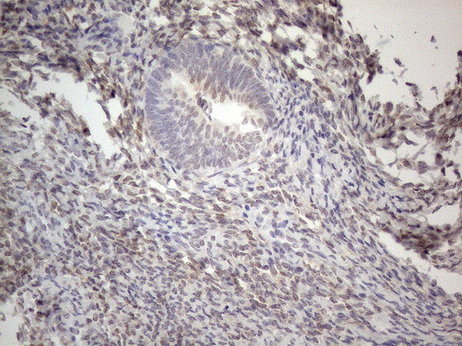 IRS1 Antibody in Immunohistochemistry (Paraffin) (IHC (P))