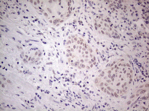 IRS1 Antibody in Immunohistochemistry (Paraffin) (IHC (P))