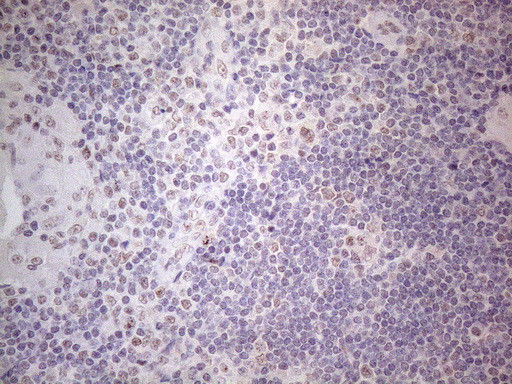 IRS1 Antibody in Immunohistochemistry (Paraffin) (IHC (P))