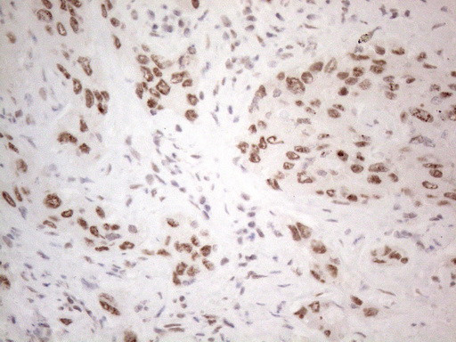 IRS1 Antibody in Immunohistochemistry (Paraffin) (IHC (P))