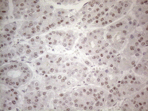 IRS1 Antibody in Immunohistochemistry (Paraffin) (IHC (P))