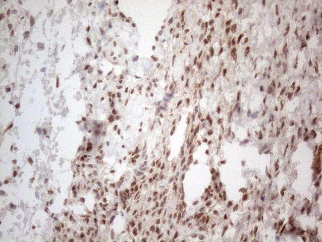 IRS1 Antibody in Immunohistochemistry (Paraffin) (IHC (P))