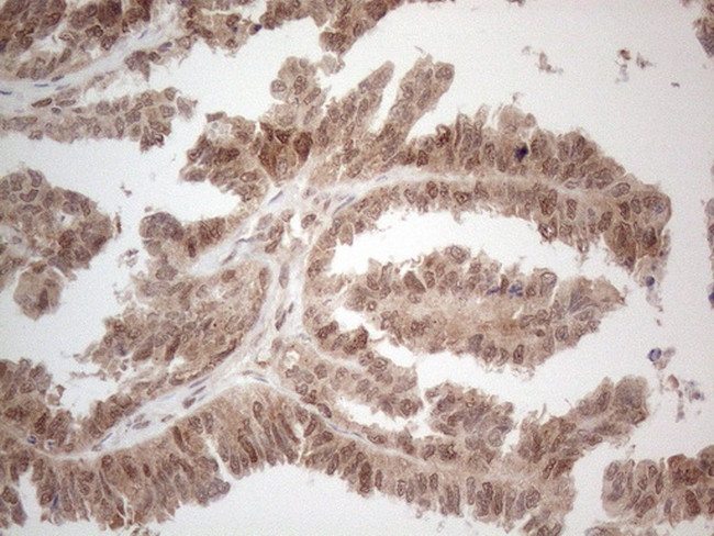 IRS1 Antibody in Immunohistochemistry (Paraffin) (IHC (P))