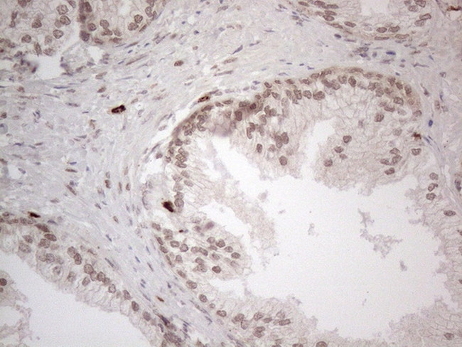 IRS1 Antibody in Immunohistochemistry (Paraffin) (IHC (P))