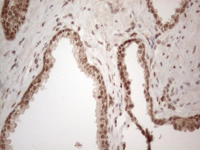 IRS1 Antibody in Immunohistochemistry (Paraffin) (IHC (P))