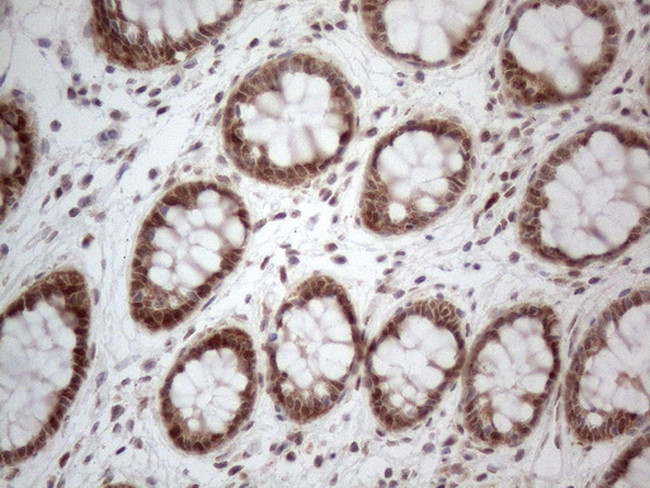 IRS1 Antibody in Immunohistochemistry (Paraffin) (IHC (P))