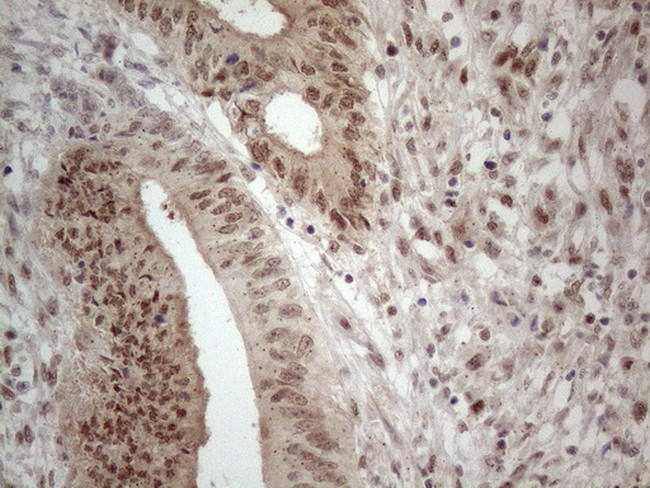 IRS1 Antibody in Immunohistochemistry (Paraffin) (IHC (P))