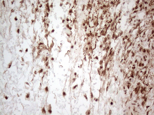 IRS1 Antibody in Immunohistochemistry (Paraffin) (IHC (P))