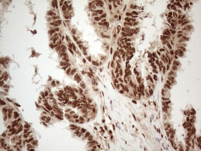 IRS1 Antibody in Immunohistochemistry (Paraffin) (IHC (P))