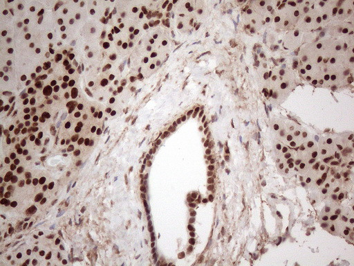 IRS1 Antibody in Immunohistochemistry (Paraffin) (IHC (P))