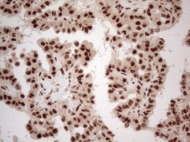 IRS1 Antibody in Immunohistochemistry (Paraffin) (IHC (P))