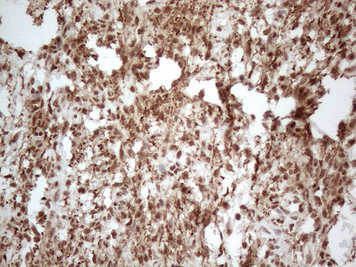 IRS1 Antibody in Immunohistochemistry (Paraffin) (IHC (P))