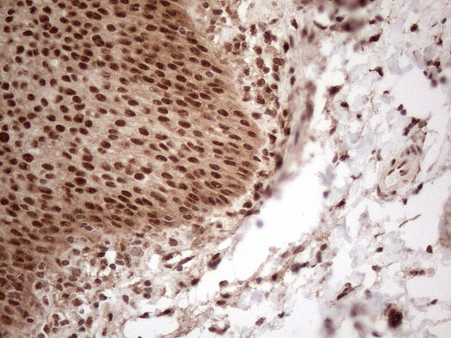 IRS1 Antibody in Immunohistochemistry (Paraffin) (IHC (P))