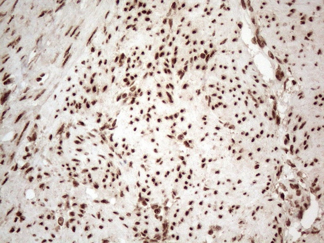 IRS1 Antibody in Immunohistochemistry (Paraffin) (IHC (P))