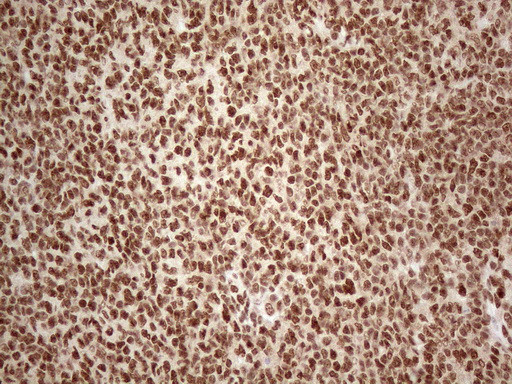 IRS1 Antibody in Immunohistochemistry (Paraffin) (IHC (P))