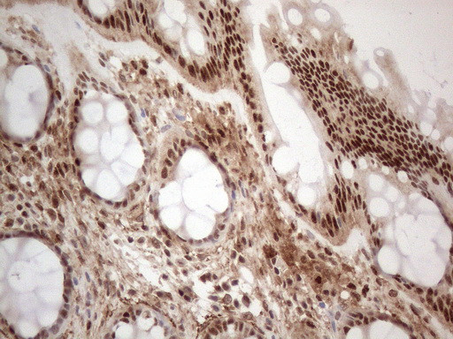 IRS1 Antibody in Immunohistochemistry (Paraffin) (IHC (P))