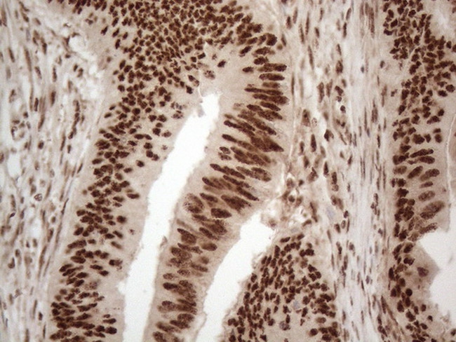 IRS1 Antibody in Immunohistochemistry (Paraffin) (IHC (P))