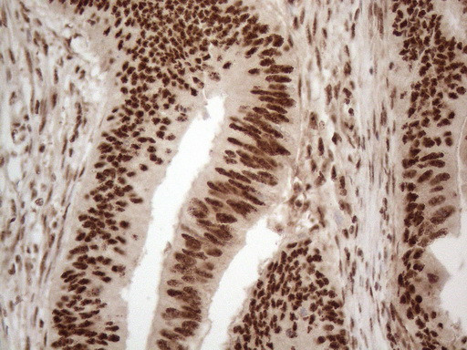 IRS1 Antibody in Immunohistochemistry (Paraffin) (IHC (P))