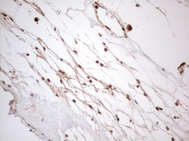 IRS1 Antibody in Immunohistochemistry (Paraffin) (IHC (P))