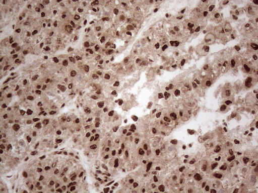 IRS1 Antibody in Immunohistochemistry (Paraffin) (IHC (P))