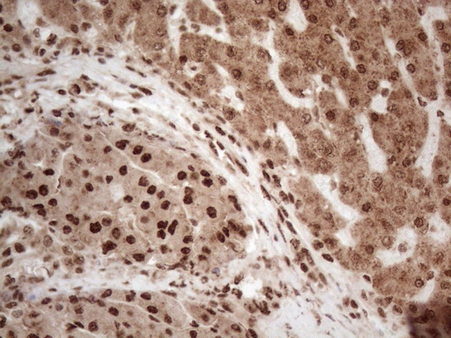 IRS1 Antibody in Immunohistochemistry (Paraffin) (IHC (P))