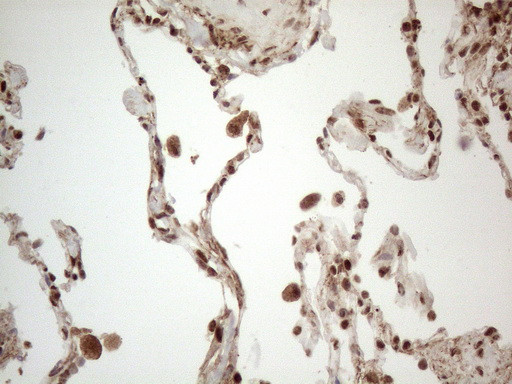 IRS1 Antibody in Immunohistochemistry (Paraffin) (IHC (P))