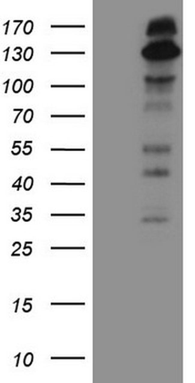 IRS1 Antibody in Western Blot (WB)