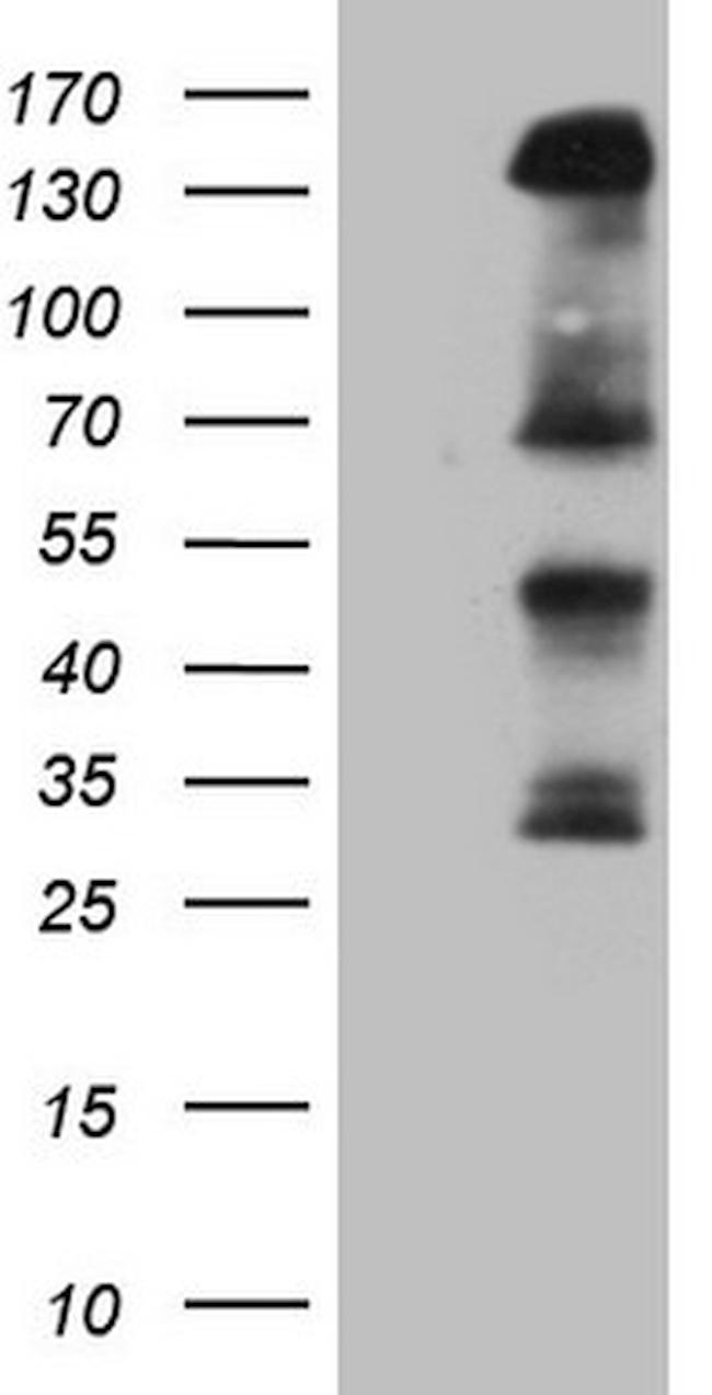 IRS1 Antibody in Western Blot (WB)