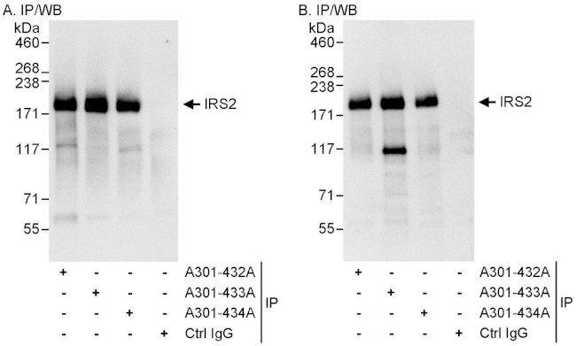 IRS2 Antibody in Immunoprecipitation (IP)