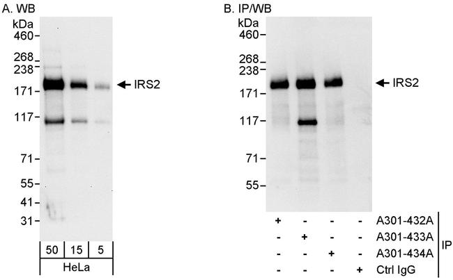 IRS2 Antibody in Western Blot (WB)