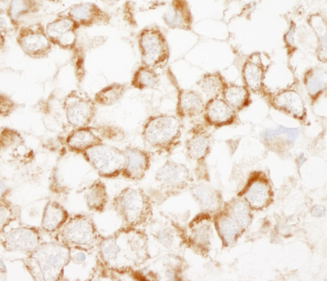 IRS2 Antibody in Immunohistochemistry (IHC)