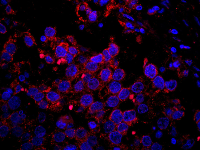 IRS2 Antibody in Immunohistochemistry (IHC)