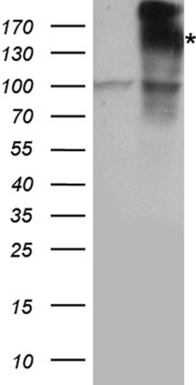 IRS2 Antibody in Western Blot (WB)