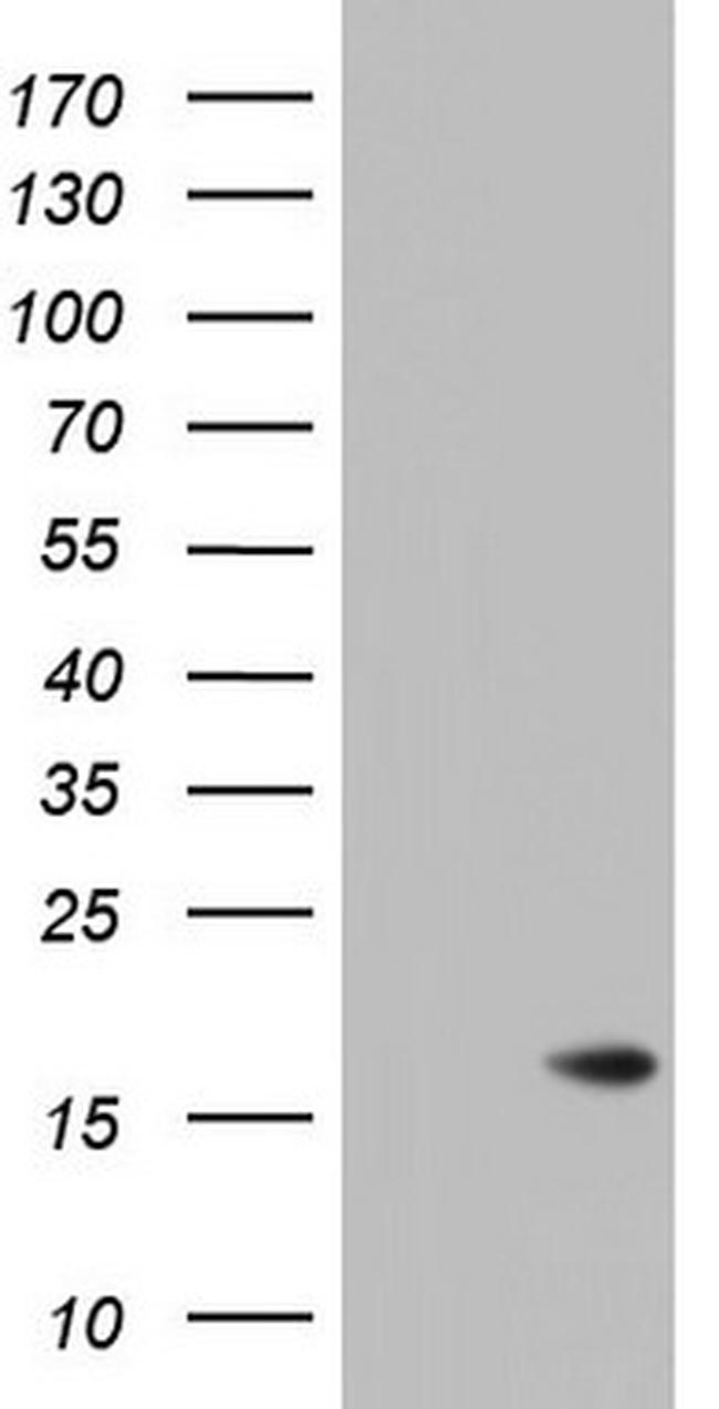 ISCU Antibody in Western Blot (WB)